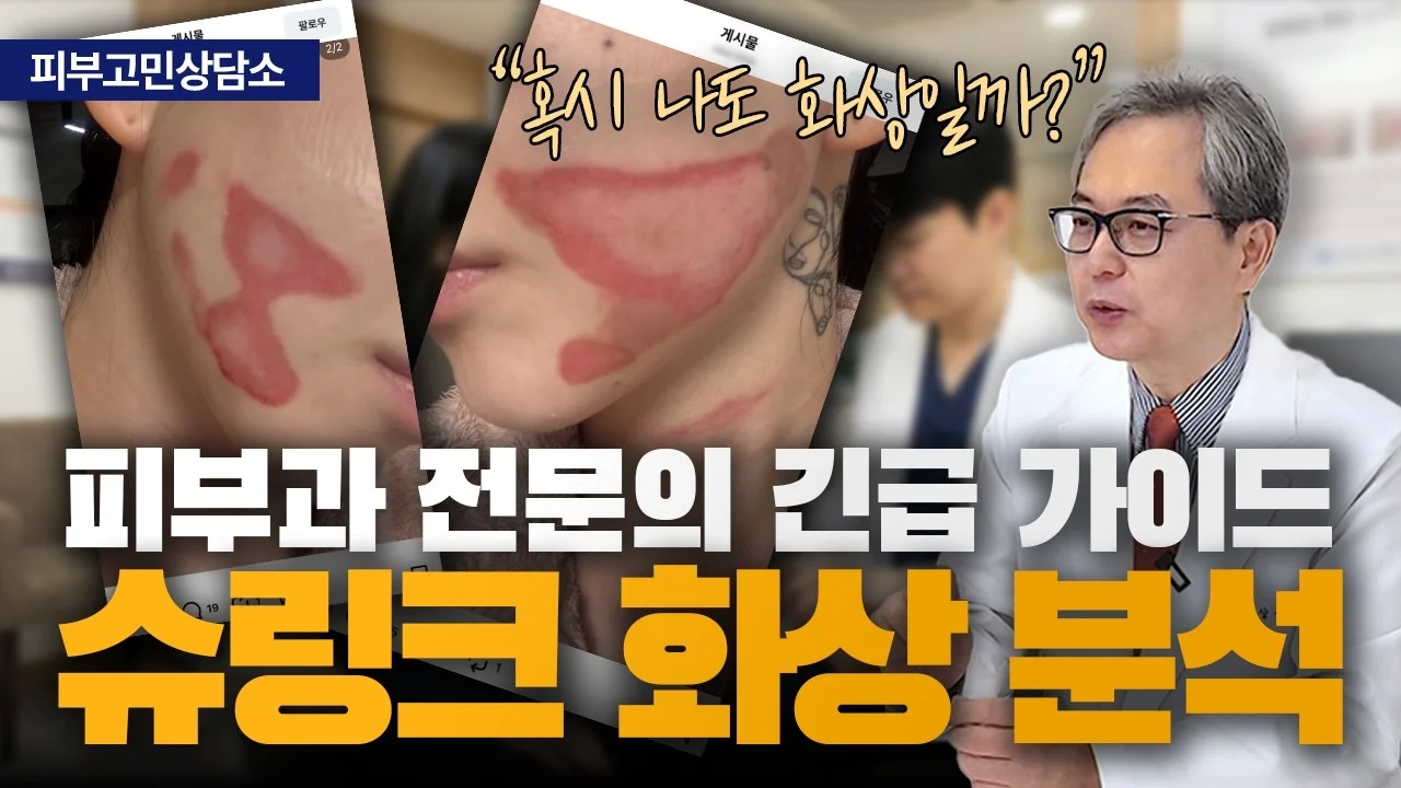 연예인 슈링크 화상 소식에 불안하셨나요? 피부과 전문의가 말하는 화상 원인과 해결법