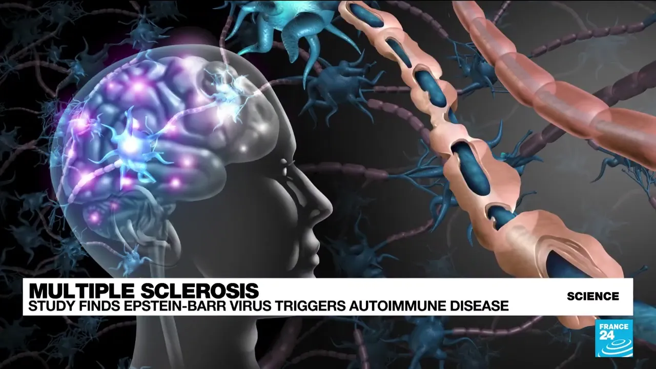 Brain and nerve fiber animation