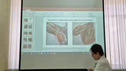 Анатомическая схема с лимфатическими узлами